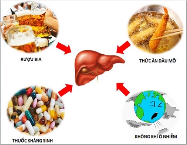 Có rất nhiều nguyên nhân gây bệnh gan do độc chất